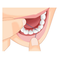 光が丘歯科 口腔内チェック