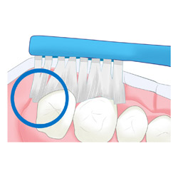 光が丘歯科 ブラッシング指導